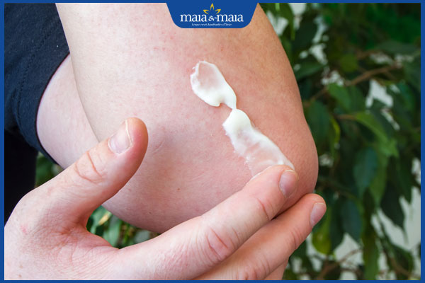 thoa kem giảm ngứa