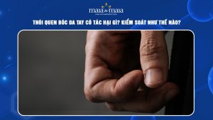 Thói quen bóc da tay