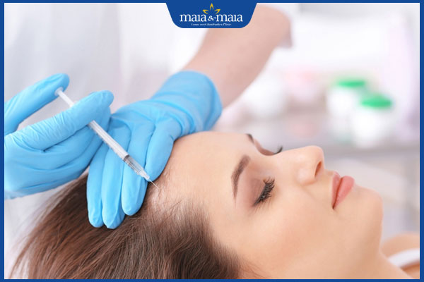 Quy trình trị rụng tóc bằng PRP như thế nào? Cần lưu ý gì? 2 thực hiện trị rụng tóc bằng prp