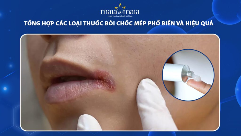 thuốc bôi chốc mép