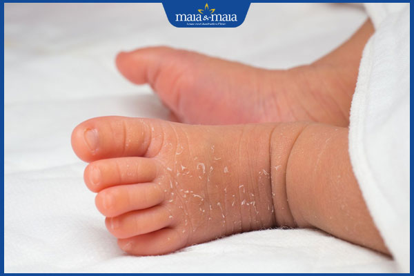 trẻ bị lột da chân