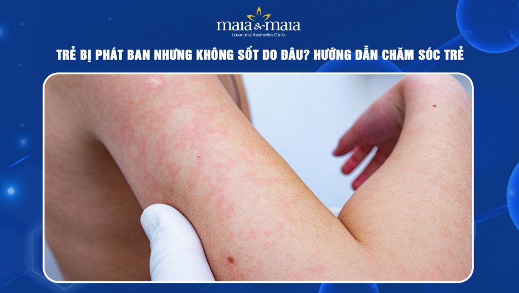 Trẻ bị phát ban nhưng không sốt
