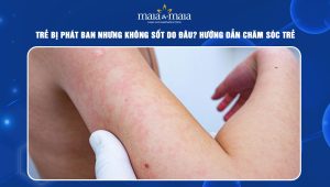 Trẻ bị phát ban nhưng không sốt