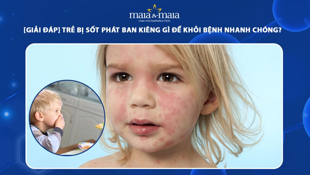 trẻ bị sốt phát ban kiêng gì