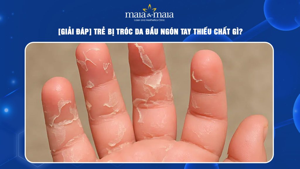 trẻ bị tróc da đầu ngón tay thiếu chất gì