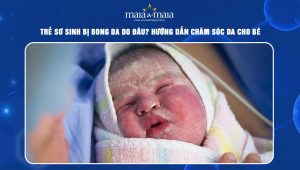 trẻ sơ sinh bị bong da