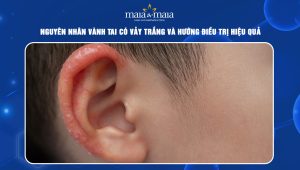 Vành tai có vảy trắng