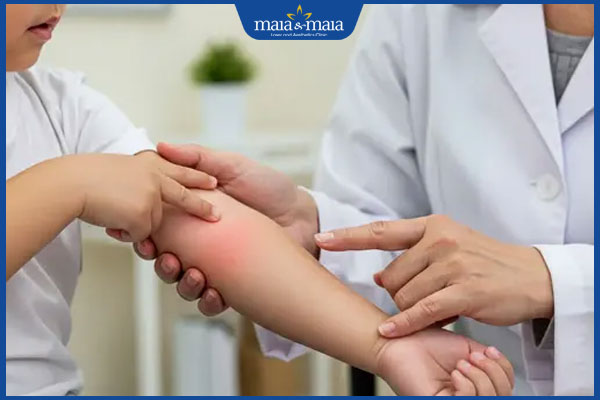 viêm mô tế bào khám bác sĩ