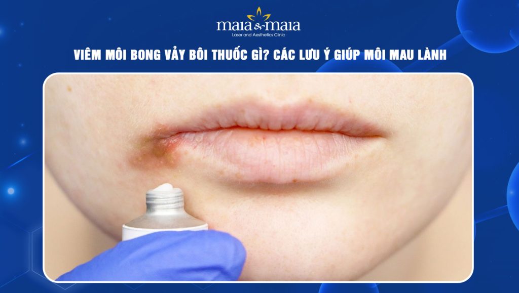 viêm môi bong vảy bôi thuốc gì