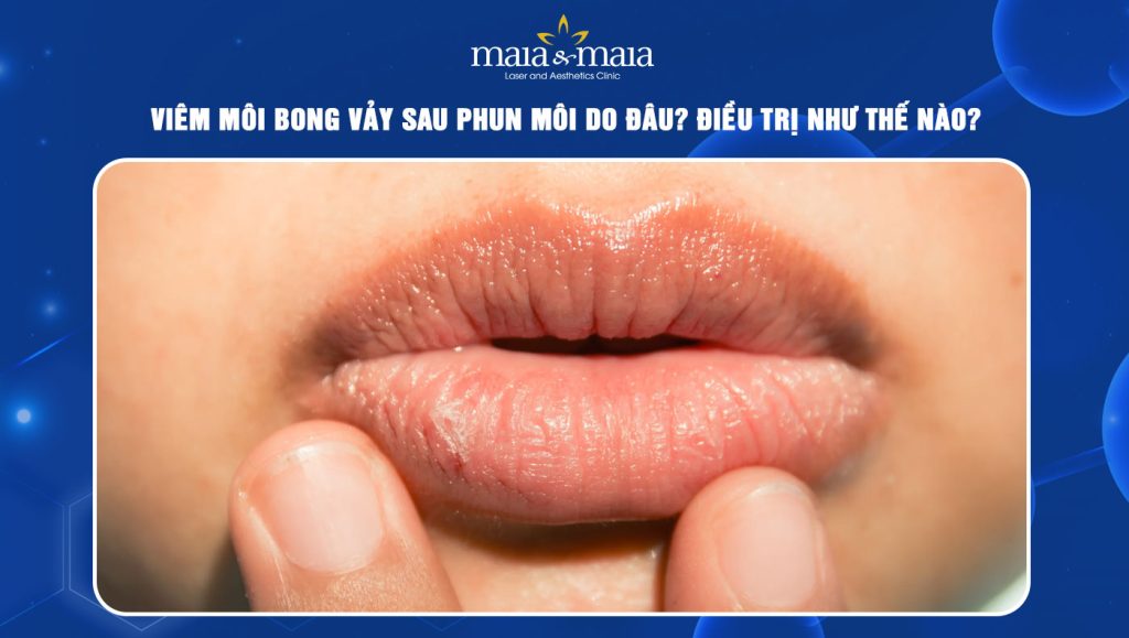 viêm môi bong vảy sau phun môi