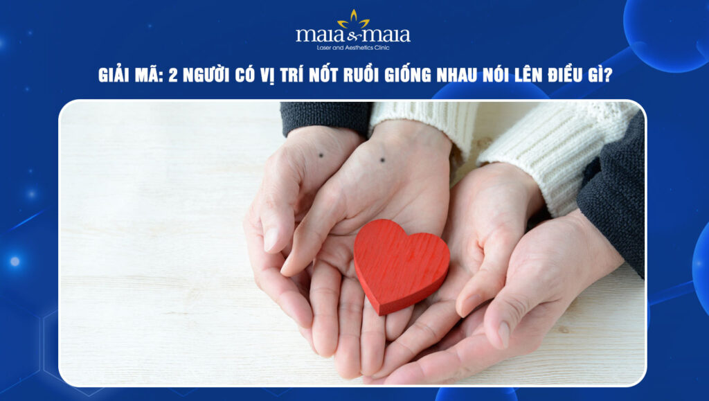 2 người có vị trí nốt ruồi giống nhau nói lên điều gì? 1 2 người có vị trí nốt ruồi giống nhau