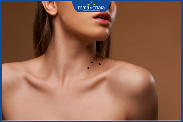 3 nốt ruồi hình tam giác ở cổ