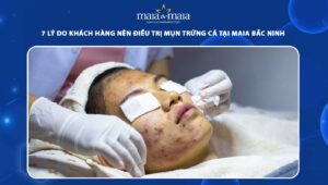 7 lý do khách hàng nên điều trị mụn trứng cá tại Maia Bắc Ninh