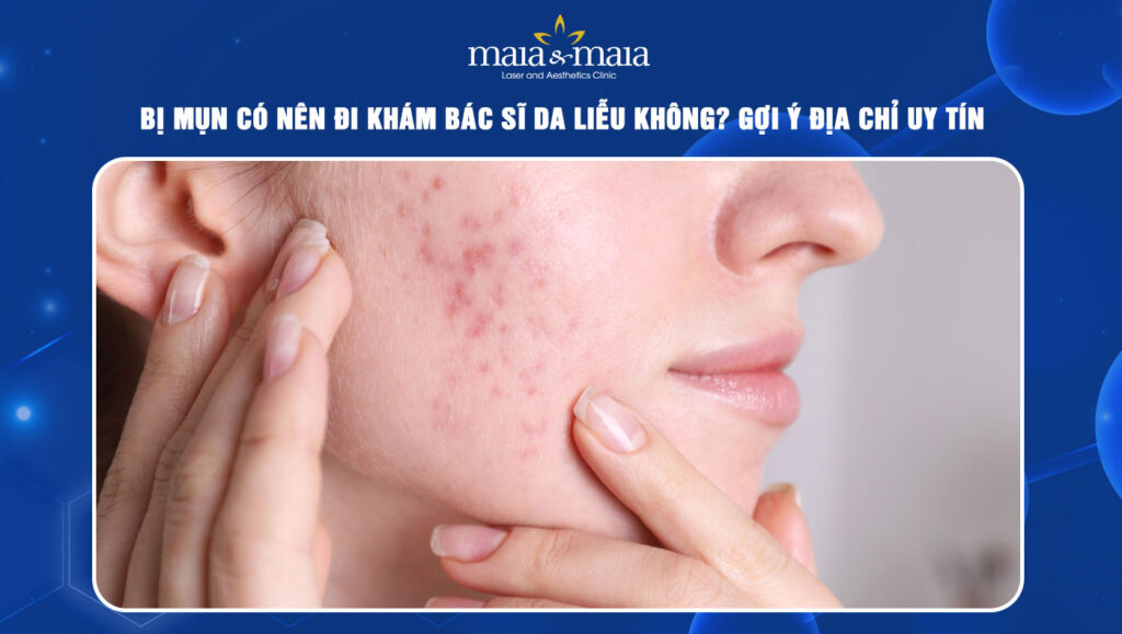 Bị mụn có nên đi khám bác sĩ da liễu? Gợi ý địa chỉ uy tín 1 Bị mụn có nên đi khám bác sĩ da liễu