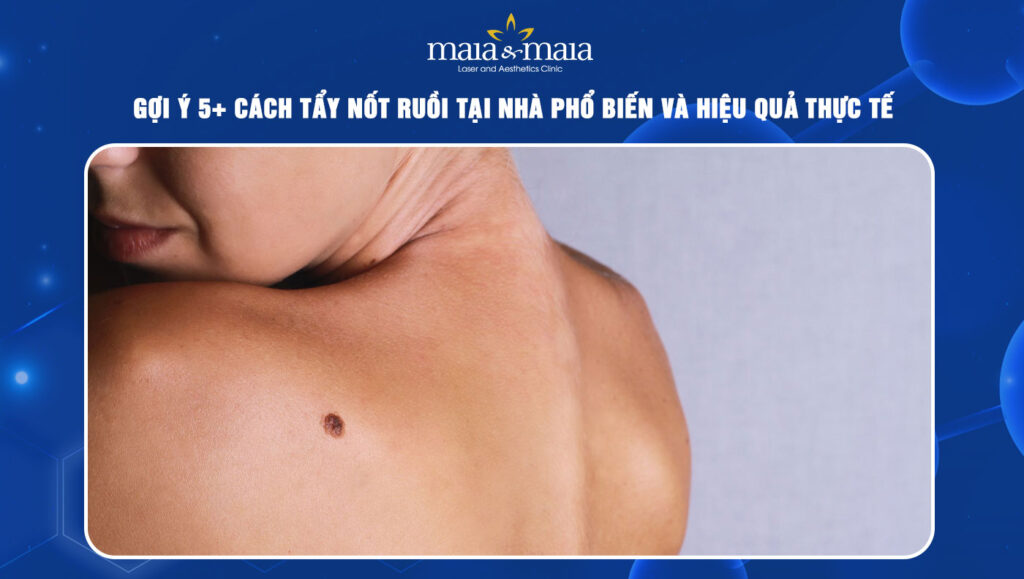 6 cách tẩy nốt ruồi tại nhà phổ biến và hiệu quả thực tế 1 cách tẩy nốt ruồi tại nhà