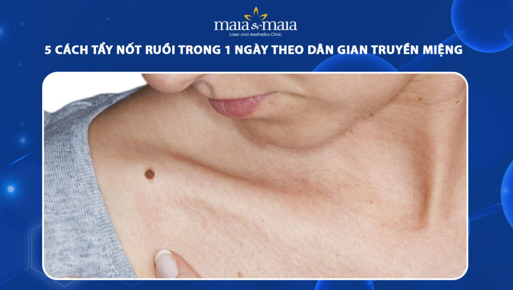 cách tẩy nốt ruồi trong 1 ngày