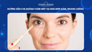 che quầng thâm mắt tại nhà