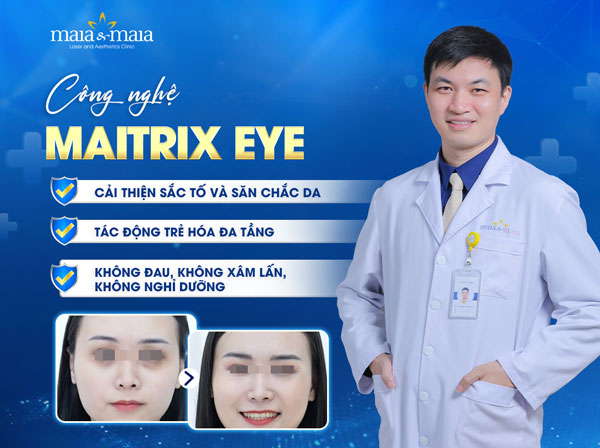 công nghệ maitrix eye trị quầng thâm mắt