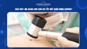 đang cho con bú tẩy nốt ruồi được không