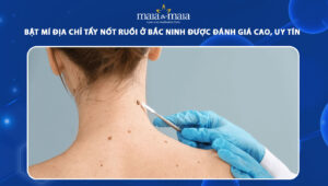 địa chỉ tẩy nốt ruồi ở bắc ninh