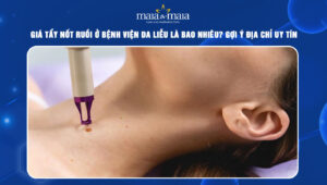 Giá tẩy nốt ruồi ở bệnh viện da liễu