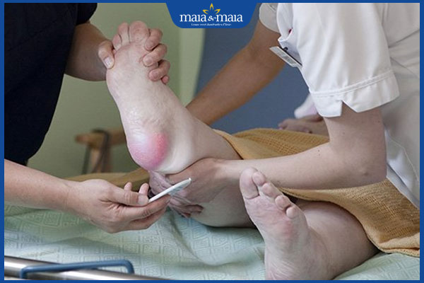 giảm áp lực loét do tỳ đè