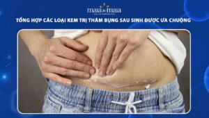 kem trị thâm bụng sau sinh