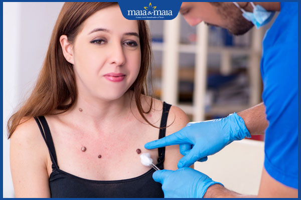 khám nốt ruồi ở ngực