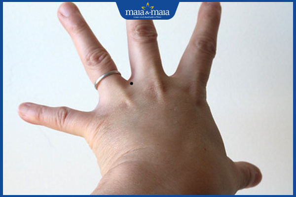 Nốt ruồi ở kẽ ngón tay tiềm ẩn ý nghĩa gì? Có nên tẩy không? 2 mọc nốt ruồi ở kẽ ngón tay