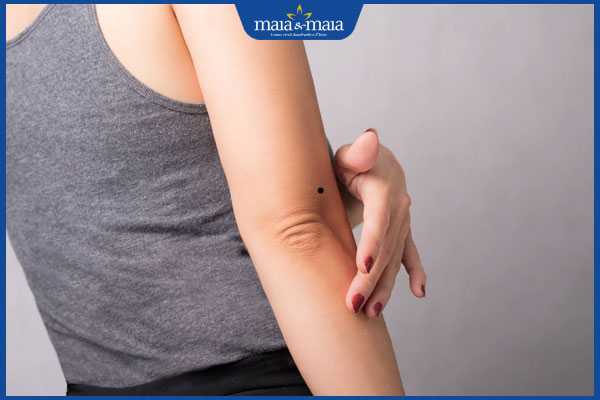 Giải mã ý nghĩa nốt ruồi ở khuỷu tay của nam và nữ giới 3 mọc nốt ruồi ở ngoài khuỷu tay