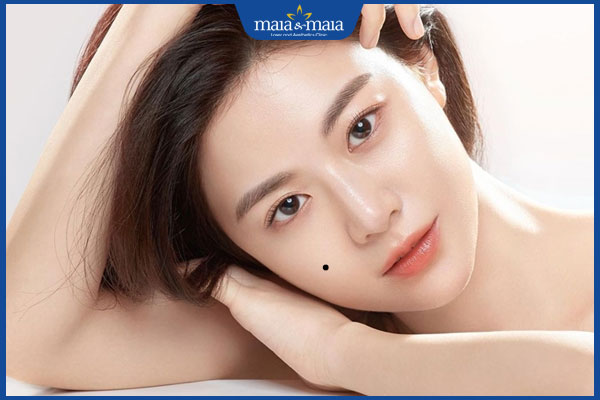 người có nốt ruồi quý