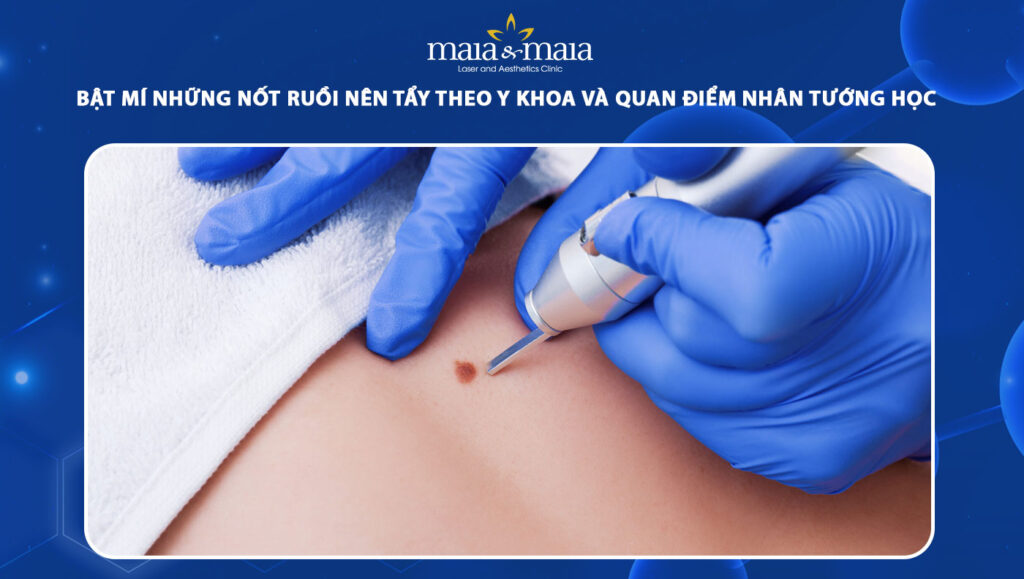 những nốt ruồi nên tẩy