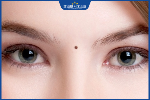 nốt ruồi ấn đường nữ