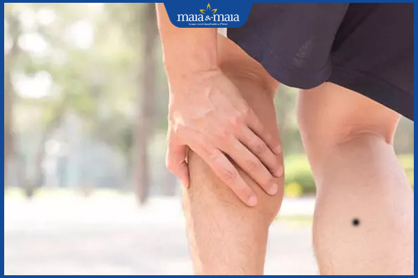 nốt ruồi bắp chân phải