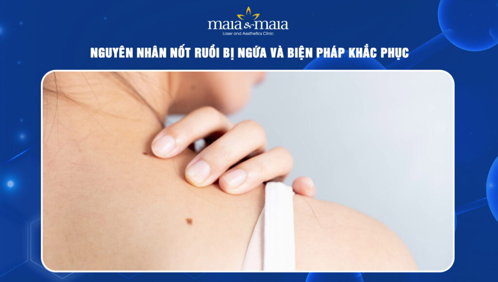 nốt ruồi bị ngứa