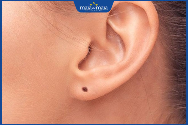 Luận giải ý nghĩa 6 vị trí nốt ruồi ở tai cho nam và nữ giới 3 nốt ruồi dái tai