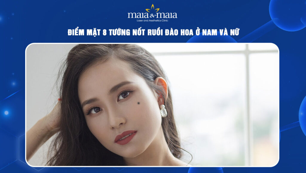 Nốt ruồi đào hoa