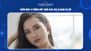 Nốt ruồi đào hoa