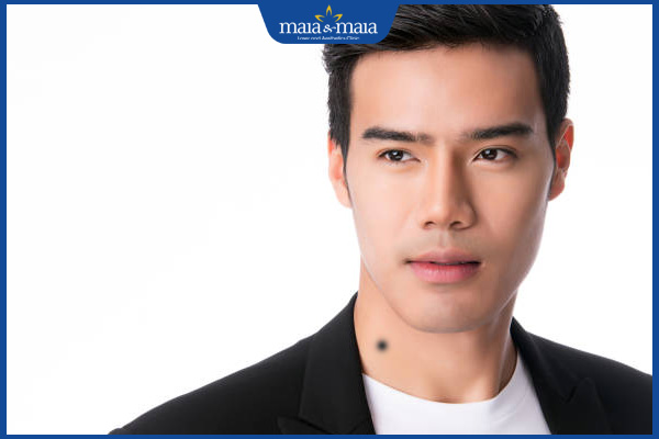 Nốt ruồi đào hoa nam