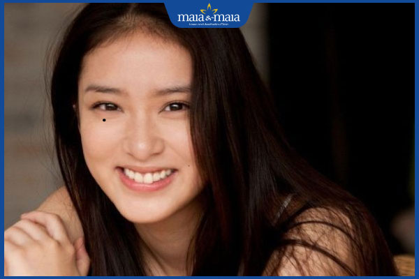 nốt ruồi đón lệ bên phải