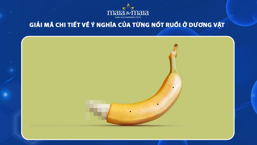 nốt ruồi ở dương vật