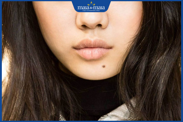 nốt ruồi duyên dưới cằm