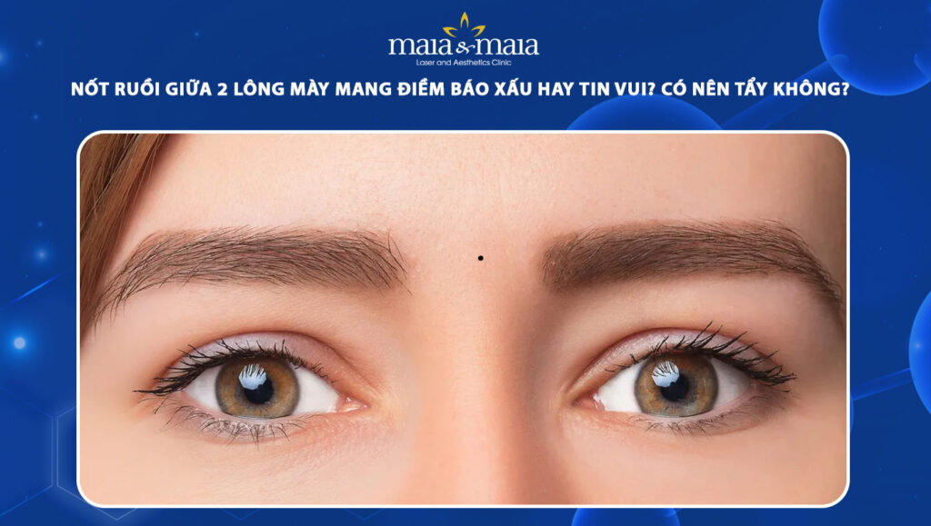 nốt ruồi giữa 2 lông mày