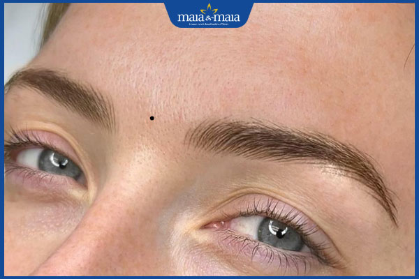 nốt ruồi giữa 2 lông mày nữ giới