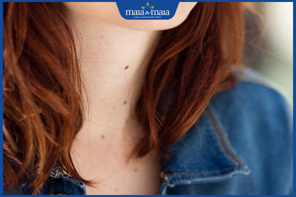 nốt ruồi hõm cổ nữ