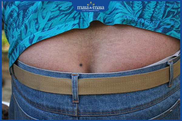 Ý nghĩa nốt ruồi ở mông theo nhân tướng học và khoa học 3 nốt ruồi khe mông