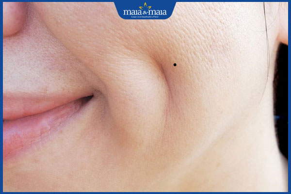 nốt ruồi lệch về bên trái má lúm