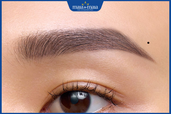 nốt ruồi mọc ở dưới lông mày