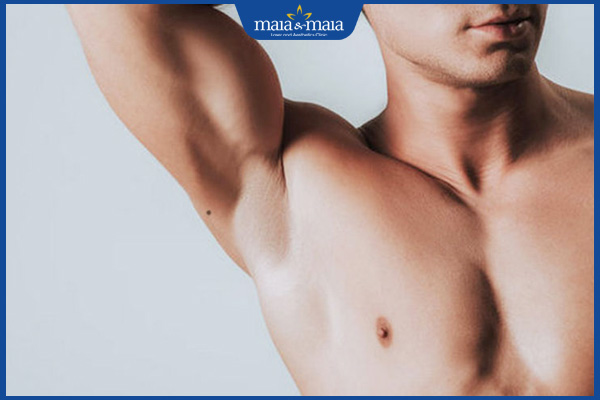 Nốt ruồi ở nách là tốt hay xấu? Khi nào nên loại bỏ? 3 nốt ruồi nách phải nam