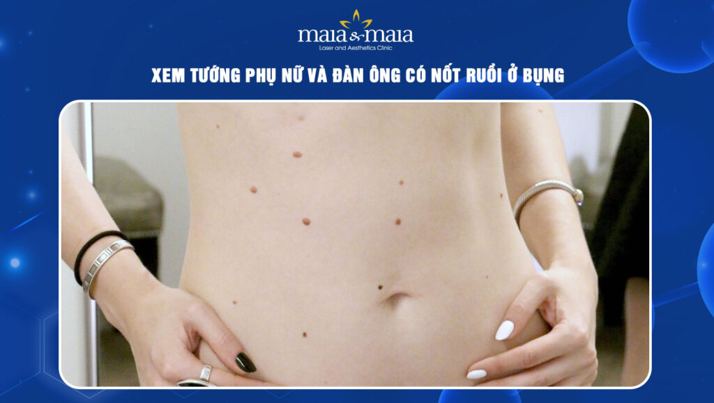 nốt ruồi ở bụng